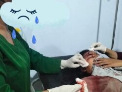 Warga Lolu di Duga Jadi Korban Pembegalan
